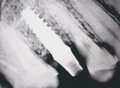 Slider image (3) Smiletec® - Leading Mexicali Dental Clinic